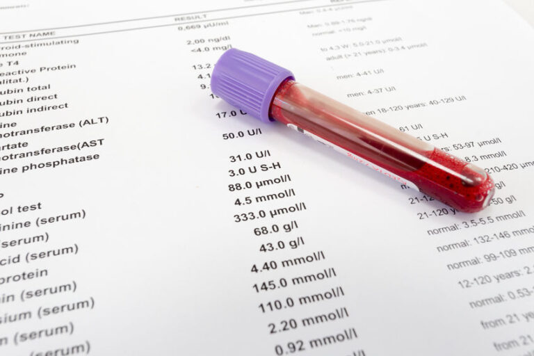 Red blood in test tube on white blank